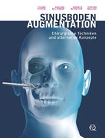   Sinusbodenaugmentation