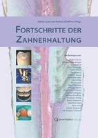  Fortschritte der Zahnerhaltung