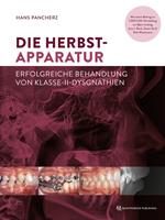   Die Herbst-Apparatur