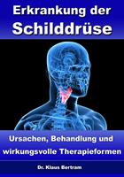   Erkrankung der Schilddrüse – Ursachen, Behandlung und wirkungsvolle Therapieformen