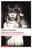   Marcas de nacimiento