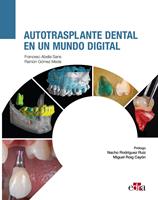   Autotrasplante dental en un mundo digital