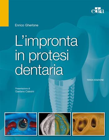 L'impronta in protesi dentaria - Enrico F. Gherlone - Libro Edra 2017 | Libraccio.it