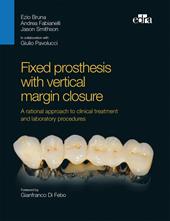 Fixed prosthesis with vertical margin closure. A rational approach to clinical treatment and laboratory procedures