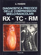 Diagnostica precoce delle compressioni mieloradicolari RX-TC-RM