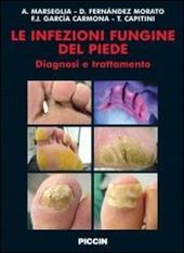 Le infezioni fungine del piede. Diagnosi e trattamento