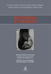 Gastroschisi e onfalocele