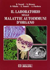 Il laboratorio nelle malattie autoimmuni d'organo