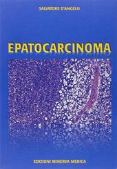 Epatocarcinoma