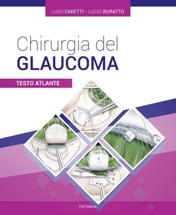 Chirurgia del glaucoma. Testo atlante - Luigi Caretti, Lucio Buratto - Libro Fabiano 2016 | Libraccio.it