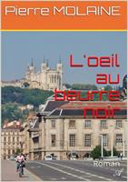   L'œil au beurre noir