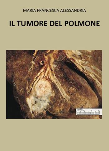 Il tumore nel polmone - Maria Francesca Alessandria - Libro Youcanprint 2023 | Libraccio.it