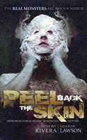   Peel Back the Skin