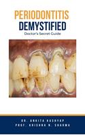   Periodontitis Demystified: Doctor's Secret Guide