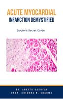   Acute Myocardial Infarction Demystified: Doctor’s Secret Guide