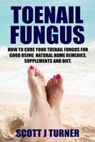 Toenail Fungus: How to Cure Your Toenail Fungus for Good using Natural Home Remedies, Supplements and Diet