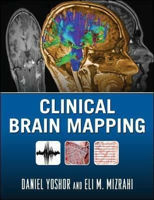 Clinical brain mapping - Daniel Yoshor, Eli M. Mizrahi - Libro McGraw-Hill Education 2009, Medicina | Libraccio.it