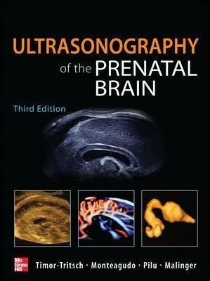 Ultrasonography of the prenatal & neonatal brain - Gustavo Malinger, Ana Monteagudo, Gianluigi Pilu - Libro McGraw-Hill Education 2012, Medicina | Libraccio.it