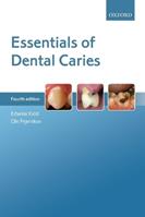 Essentials of Dental Caries - Edwina Kidd, Ole Fejerskov - Libro Oxford University Press | Libraccio.it