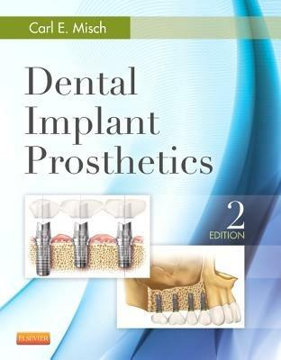Dental Implant Prosthetics - Carl E. Misch - Libro Elsevier - Health Sciences Division | Libraccio.it