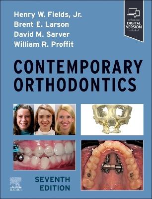Contemporary Orthodontics - Henry Fields, Brent Larson, David M. Sarver - Libro Elsevier - Health Sciences Division | Libraccio.it