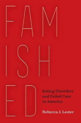 Famished - Rebecca J. Lester - Libro University of California Press | Libraccio.it