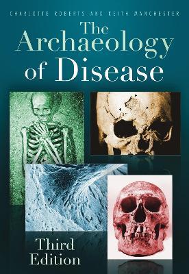 The Archaeology of Disease - Charlotte Roberts, Keith Manchester - Libro The History Press Ltd | Libraccio.it