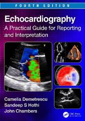 Echocardiography