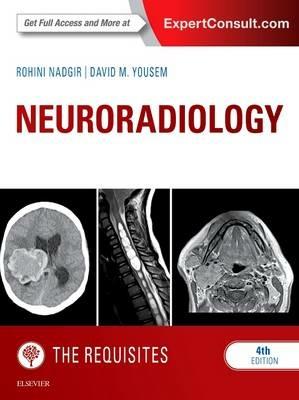 Neuroradiology: The Requisites - Rohini Nadgir, David M. Yousem - Libro Elsevier - Health Sciences Division, The Core Requisites | Libraccio.it