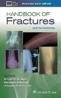 Handbook of Fractures  - Libro Lippincott Williams and Wilkins | Libraccio.it