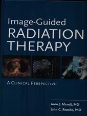 Image guided radiation therapy