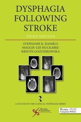 Dysphagia Following Stroke - Stephanie K. Daniels, Maggie Lee Huckabee, Kristin Gozdzikowska - Libro Plural Publishing Inc | Libraccio.it