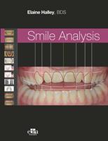 Smile analysis. Ediz. italiana - Elaine Halley - Libro Edra Publishing 2022 | Libraccio.it