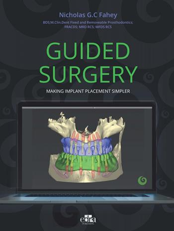 Guided surgery. Making implant placement simpler - Nicholas G.C. Fahey - Libro Edra Publishing 2022 | Libraccio.it