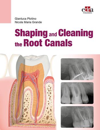 Shaping and Cleaning the Root Canals - Gianluca Plotino, Nicola Maria Grande - Libro Edra 2023 | Libraccio.it