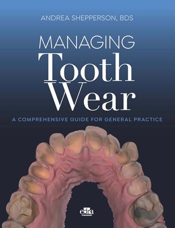 Managing tooth Wear. A comprehensive guide for general practice - Andrea Shepperson - Libro Edra 2023 | Libraccio.it