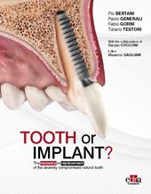 Tooth or Implant? The recovery or replacement of the severely compormised natural tooth