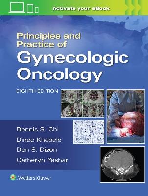 Principles and Practice of Gynecologic Oncology - DENNIS CHI, Andrew Berchuck, Don S. Dizon - Libro Wolters Kluwer Health | Libraccio.it