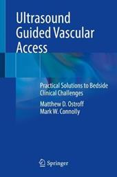 Ultrasound Guided Vascular Access