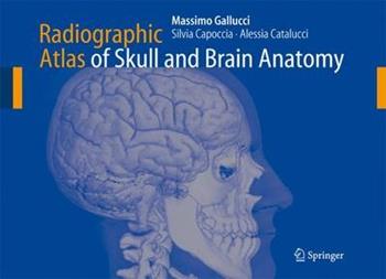 Radiographic Atlas of Skull and Brain Anatomy - Massimo Gallucci, Silvia Capoccia, Alessia Catalucci - Libro Springer-Verlag Berlin and Heidelberg GmbH & Co. KG | Libraccio.it