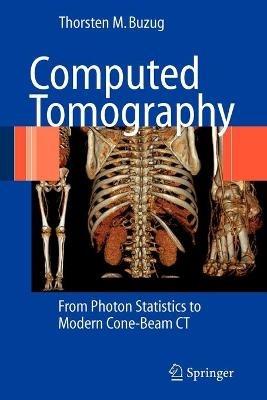 Computed Tomography - Thorsten M. Buzug - Libro Springer-Verlag Berlin and Heidelberg GmbH & Co. KG | Libraccio.it