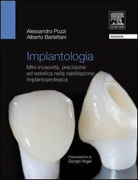Implantologia. Mini-invasività, precisione ed estetica nella riabilitazione implantoprotesica - Alessandro Pozzi, Alberto Barlattani - Libro Elsevier 2009 | Libraccio.it