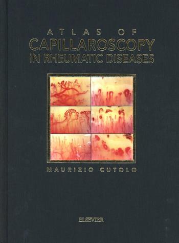 Atlas of capillaroscopy in rheumatic diseases - Maurizio Cutolo - Libro Elsevier 2010 | Libraccio.it