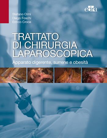 Trattato di chirurgia laparoscopica. Apparato digerente, surrene e obesità - Stefano Olmi, Diego Foschi, Enrico Croce - Libro Edra 2017 | Libraccio.it