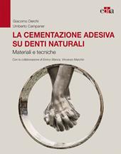 La cementazione adesiva su denti naturali. Materiali e tecniche