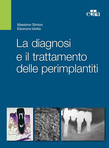 La diagnosi e il trattamento delle perimplantiti - Massimo Simiom, Eleonora Idotta - Libro Edra 2015 | Libraccio.it
