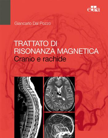 Trattato di risonanza magnetica. Cranio e rachide - Giancarlo Dal Pozzo - Libro Edra 2018 | Libraccio.it