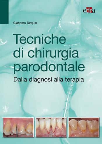 Tecniche di chirurgia parodontale. Dalla diagnosi alla terapia - Giacomo Tarquini - Libro Edra 2017 | Libraccio.it