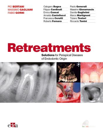 Ritrattamenti. Soluzioni per le patologie periapicali di origine endodontica  - Libro Edra 2019 | Libraccio.it