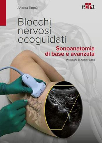 Blocchi nervosi ecoguidati. Sonoanatomia di base avanzata - Andrea Tognù - Libro Edra 2017 | Libraccio.it